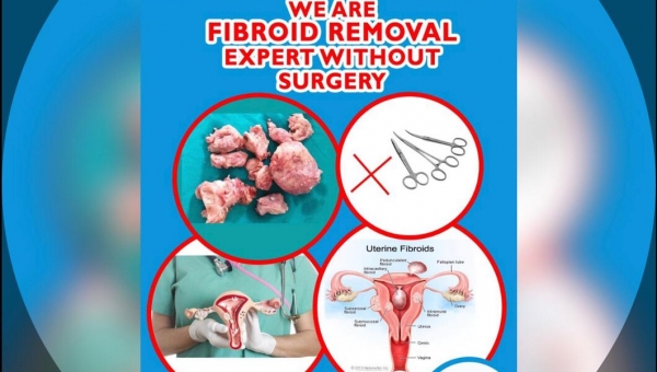 Fibroid Removal Expert Without Surgery